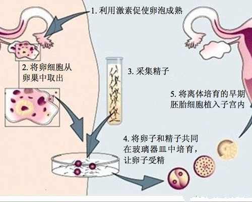 医院试管代孕,拉萨三代试管如何筛选性别_试管助孕生子助孕机构
