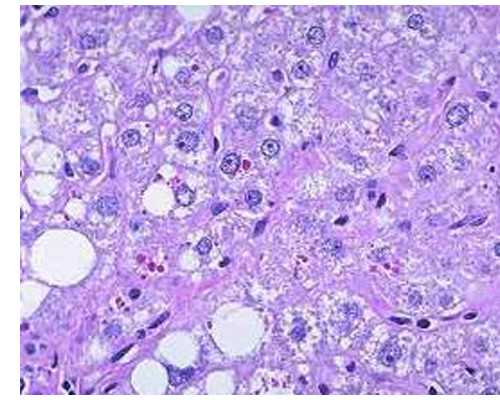 南京代怀公司比较,做试管月经第二天检查什么-试管移植鲜胚12天血值多少正常