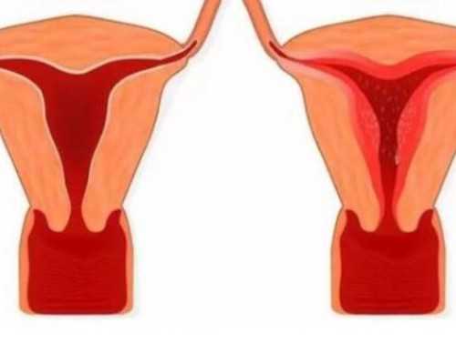 代生报价,北京附件炎怎么才能生育-供卵捐卵试管孩子助孕机构在哪里-助孕机构