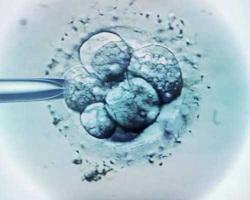 南京供卵在哪,丈夫无精不能生育，能做试管婴儿吗_南京公立医院供卵_移植后能