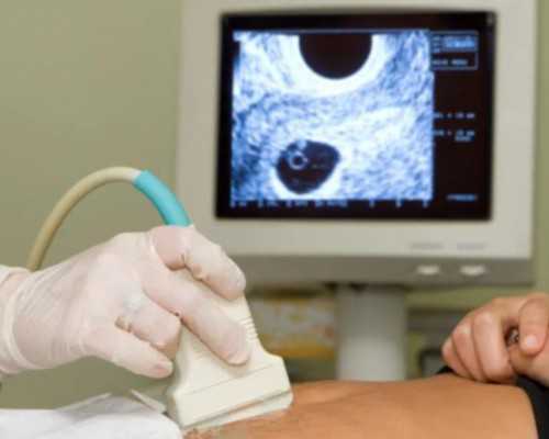 南通做供卵试管的医院名单已公开,外院取卵6次，从南通到南通，黎雪玲主任圆