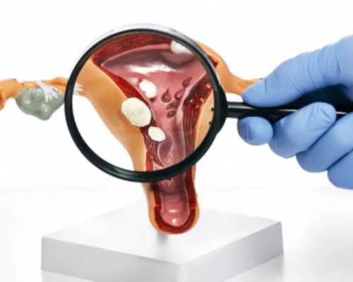 代孕哪里安全,哪些食物能够助孕，适合备孕的人群吃？