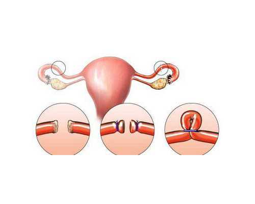 私立供卵中心,现在做滁州助孕第三代试管婴儿贵吗