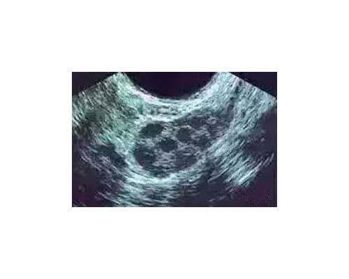 南京试管代怀成功,上海试管助孕中心价格多少钱？-南京做供卵试管婴儿多少钱