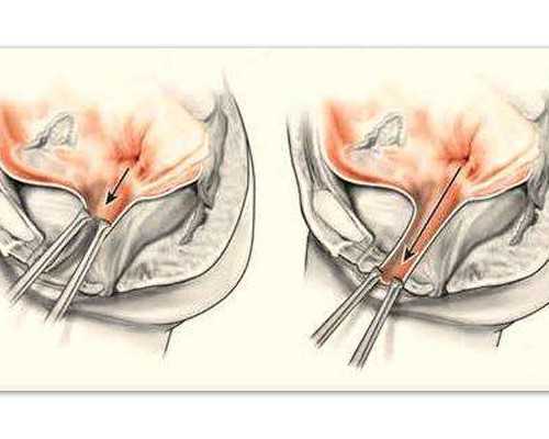 南京试管代孕医院排名,做试管婴儿移植，胚胎发育迟缓的原因_南京供卵医院成