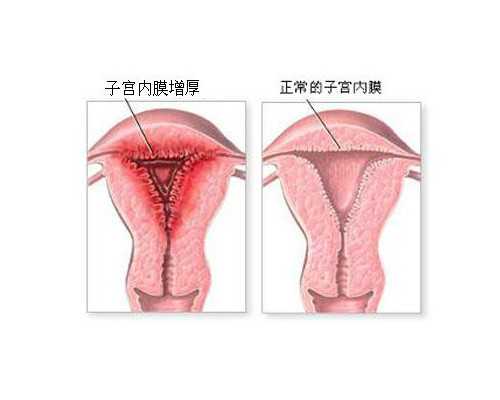 代生费用问题,聚焦：济源无精可以通过试管助孕吗