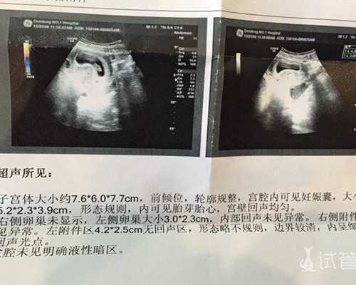 南京哪里的代孕医院好,2026年做泰国试管婴儿流程，免费看了-上海供卵试管公司