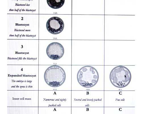 南京代孕套餐有哪些,试管婴儿宫外孕征兆有哪些，出现四个症状你可能宫外孕