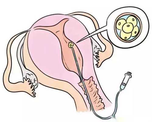 苏州代怀助孕公司,2026上海做试管比较好的医院是哪家？_试管中D3是什么意思