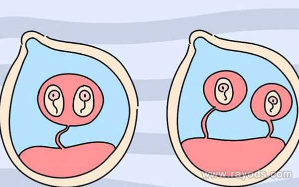 试管放一个胚胎是正确选择_浙江试管婴儿捐卵供卵_试管婴儿需要什么条件才可