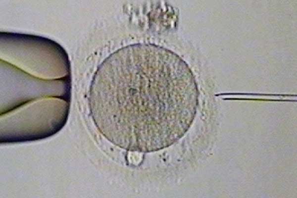 试管选择性别价格_二代试管移植几个胚胎_俄罗斯试管婴儿基因检测对囊胚会有
