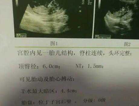广州哪家医院可做供卵试管_供卵试管婴儿孩子跟母亲算_多地拟将试管婴儿费用