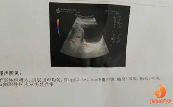 南京代孕去哪里最好,【南京市妇幼供卵试管45岁供卵成功率】因为是顺转刨意外